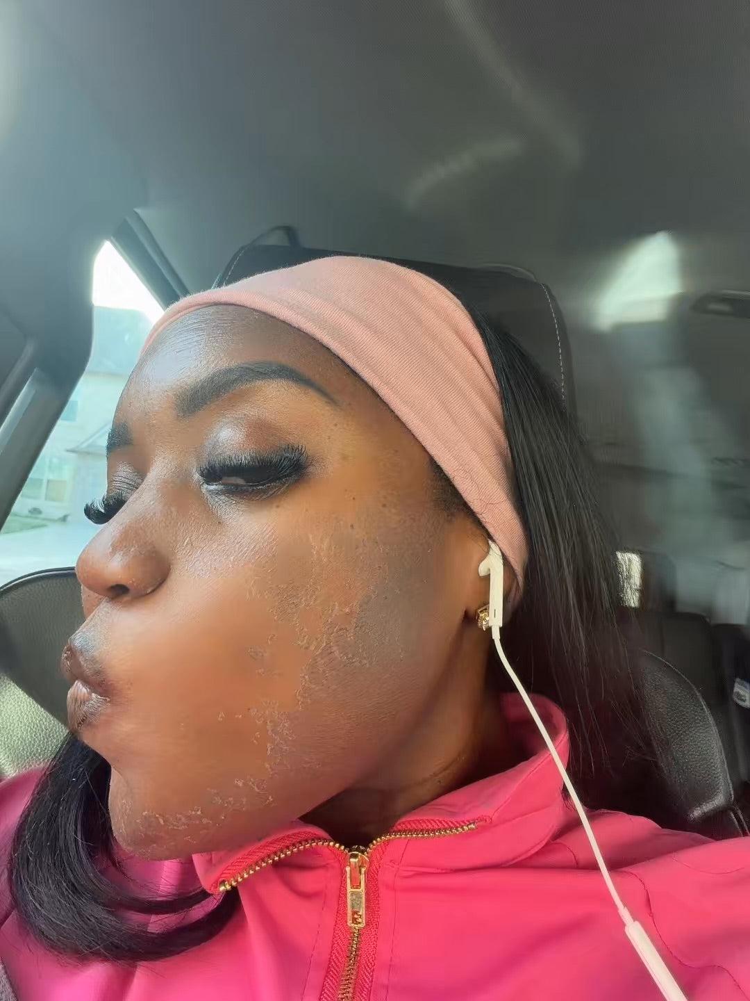 Pretty Peel Package™️|3 Peels
